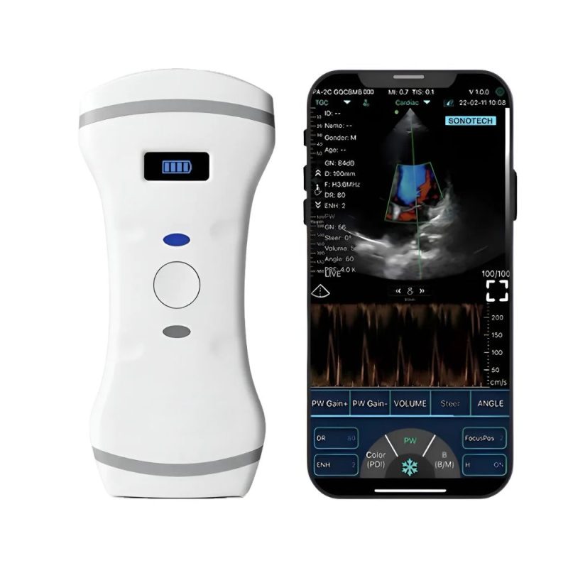 Ultrassom Portátil 256 Elementos (3 em 1)